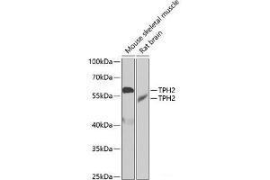 Western blot analysis of extracts of various cell lines using TPH2 Polyclonal Antibody at dilution of 1:1000. (Tryptophan Hydroxylase 2 Antikörper)
