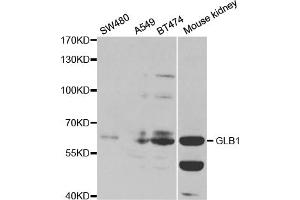 Western blot analysis of extracts of various cell lines, using GLB1 antibody (ABIN5970957) at 1/1000 dilution. (GLB1 Antikörper)
