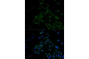 Immunofluorescence analysis of A549 cell using ARF6 antibody. (ARF6 Antikörper)
