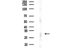 anti-Prodynorphin (PDYN) (C-Term) antibody