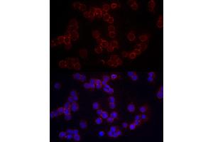 Immunofluorescence analysis of Raji cells using CD86 Rabbit pAb (ABIN3021700, ABIN3021701, ABIN3021702, ABIN1512724 and ABIN6215549) at dilution of 1:200 (40x lens). (CD86 Antikörper  (AA 30-247))