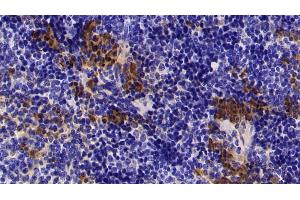 Detection of S100A8 in Mouse Spleen Tissue using Polyclonal Antibody to S100 Calcium Binding Protein A8 (S100A8)