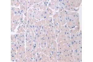 IHC-P analysis of Mouse Tissue, with DAB staining. (BMP10 Antikörper  (AA 314-421))