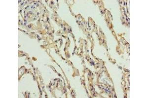 Immunohistochemistry of paraffin-embedded human lung tissue using ABIN7169988 at dilution of 1:100 (Solute Carrier Family 34 (Type II Sodium/phosphate Contransporter), Member 1 (SLC34A1) (AA 1-103) Antikörper)
