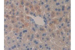 Detection of DLD in Mouse Liver Tissue using Polyclonal Antibody to Dihydrolipoyl Dehydrogenase (DLD) (DLD Antikörper  (AA 45-271))