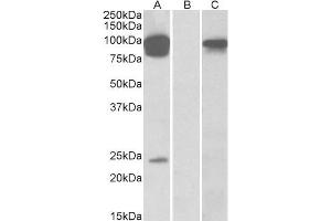 HEK293 lysate (10ug protein in RIPA buffer) overexpressing Human TRPV3 with DYKDDDDK tag probed with ABIN570683 (0. (TRPV3 Antikörper  (AA 762-773))