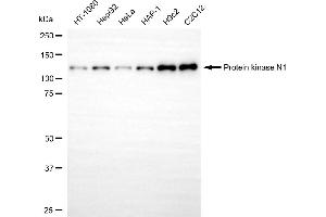 Western blotting analysis using protein kinase N1 antibody (ABIN7800005). (Rekombinanter PKN1 Antikörper)