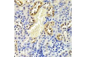 Immunohistochemistry of paraffin-embedded mouse kidney using CDKN1B Antibody. (CDKN1B Antikörper)