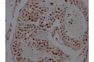 IHC image of ABIN7127590 diluted at 1:100 and staining in paraffin-embedded human testis tissue performed on a Leica BondTM system. (Rekombinanter LSD1 Antikörper)