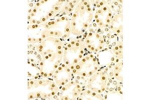 Immunohistochemistry (Paraffin-embedded Sections) (IHC (p)) image for anti-RNA Binding Motif Protein 45 (RBM45) antibody (ABIN7075477)