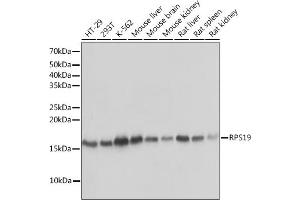 Western blot analysis of extracts of various cell lines, using RPS19 Rabbit mAb (ABIN1681275, ABIN3017969, ABIN3017970 and ABIN7101552) at 1:1000 dilution. (RPS19 Antikörper)