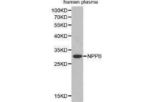 Western Blotting (WB) image for anti-Natriuretic Peptides B (NPPB) (AA 1-134) antibody (ABIN3023136) (NPPB Antikörper  (AA 1-134))