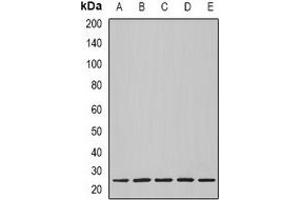 Western blot analysis of Nop30 expression in BT474 (A), MCF7 (B), mouse heart (C), mouse lung (D), rat heart (E) whole cell lysates. (NOL3 Antikörper)