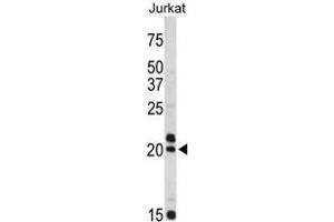 Western blot analysis of VIP antibody (C-term) in Jurkat cell line lysates (35ug/lane).