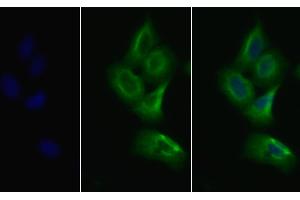 Detection of VEGFR2 in Human MCF7 cell using Polyclonal Antibody to Vascular Endothelial Growth Factor Receptor 2 (VEGFR2) (VEGFR2/CD309 Antikörper  (AA 46-320))