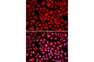 Immunofluorescence analysis of U2OS cells using IPO5 antibody. (Importin 5 Antikörper  (AA 20-300))