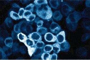 Immunofluorescent staining of A431 cells. (C-Raf-1 (AA 162-378) Antikörper)