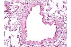 Immunohistochemistry (IHC) image for anti-Vascular Endothelial Growth Factor A (VEGFA) antibody (ABIN1104978)