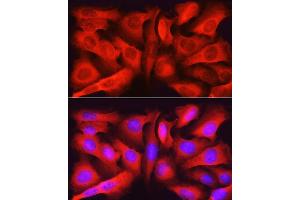 Immunofluorescence analysis of U2OS cells using ASNS Rabbit pAb (ABIN6127372, ABIN6137209, ABIN6137210 and ABIN6221207) at dilution of 1:50 (40x lens). (Asparagine Synthetase Antikörper  (AA 262-561))