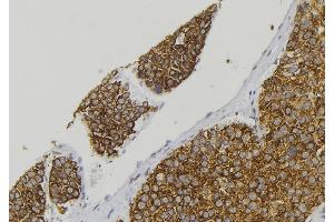 ABIN6278430 at 1/100 staining Human pancreas tissue by IHC-P. (CGRP Antikörper  (Internal Region))