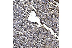 IHC analysis of EGFR using anti-EGFR antibody (ABIN7600915). (EGFR Antikörper  (AA 25-596))