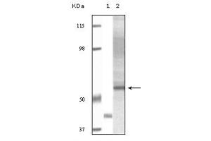 Western blot analysis using Akt3 monoclonal antibody against truncated Akt3 recombinant protein and human ovary carcinoma tissue lysate . (AKT3 Antikörper  (truncated))