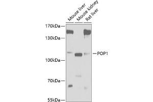Western blot analysis of extracts of various cell lines, using POP1 antibody (ABIN6133335, ABIN6145961, ABIN6145962 and ABIN6221643) at 1:1000 dilution. (POP1 Antikörper  (AA 1-210))