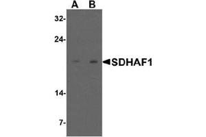 Western blot analysis of SDHAF1 in 3T3 cell lysate with SDHAF1 antibody at (A) 1 and (B) 2 ug/mL. (SDHAF1 Antikörper  (C-Term))