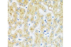 Immunohistochemistry of paraffin-embedded Human liver using ASGR1 Polyclonal Antibody at dilution of 1:100 (40x lens). (Asialoglycoprotein Receptor 1 Antikörper)