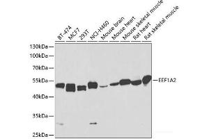 Western blot analysis of extracts of various cell lines using EEF1A2 Polyclonal Antibody at dilution of 1:1000. (EEF1A2 Antikörper)