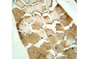 Immunohistochemistry (IHC) image for anti-Cyclin-Dependent Kinase Inhibitor 2C (p18, Inhibits CDK4) (CDKN2C) (AA 113-139) antibody (ABIN3030649)