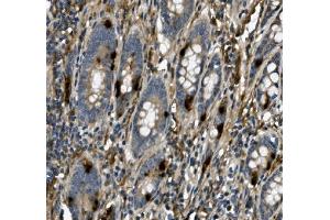 IHC analysis of USP44 using anti-USP44 antibody (ABIN7600640). (USP44 Antikörper  (AA 211-712))