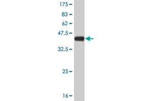 Western Blot detection against Immunogen (37. (STMN2 Antikörper  (AA 73-179))