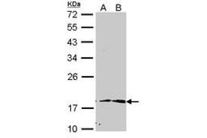 Image no. 1 for anti-Peptidylprolyl Cis/trans Isomerase, NIMA-Interacting 1 (PIN1) (AA 1-133) antibody (ABIN467591) (PIN1 Antikörper  (AA 1-133))