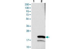 Western blot analysis of Lane 1: Negative control (vector only transfected HEK293T lysate), Lane 2: Over-expression Lysate (Co-expressed with a C-terminal myc-DDK tag (~3. (TMEM243 Antikörper)