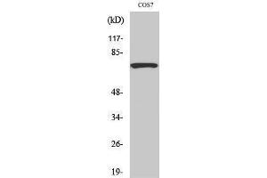 Western Blotting (WB) image for anti-Spleen tyrosine Kinase (SYK) (Tyr1333) antibody (ABIN3187115) (SYK Antikörper  (Tyr1333))