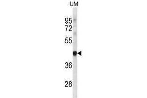 TRUB1 Antibody (Center) western blot analysis in UM cell line lysates (35 µg/lane). (TRUB1 Antikörper  (Middle Region))