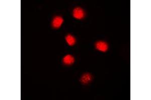 Immunofluorescent analysis of Cyclin E1 staining in MCF7 cells. (Cyclin E1 Antikörper  (C-Term))