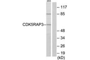 Western blot analysis of extracts from 293 cells, using CDK5RAP3 Antibody.