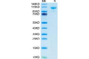 LRP5 Protein (AA 644-1263) (mFc Tag)