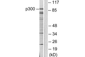 Western Blotting (WB) image for anti-CREB Binding Protein (CREBBP) (C-Term) antibody (ABIN1848718) (CBP Antikörper  (C-Term))