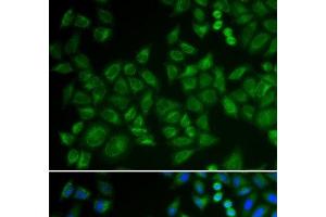 Immunofluorescence analysis of HeLa cells using SMPD1 / ASM Polyclonal Antibody (SMPD1 Antikörper)