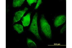 Image no. 2 for anti-conserved Helix-Loop-Helix Ubiquitous Kinase (CHUK) (AA 646-745) antibody (ABIN598612) (IKK alpha Antikörper  (AA 646-745))