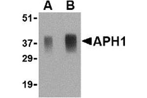 Western Blotting (WB) image for anti-Anterior Pharynx Defective 1 Homolog A (C. Elegans) (APH1A) (Middle Region) antibody (ABIN1030864) (APH1A Antikörper  (Middle Region))