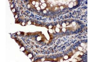 Immunohistochemistry (IHC) image for anti-P450 (Cytochrome) Oxidoreductase (POR) antibody (ABIN4952222)
