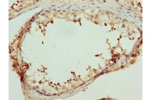 Immunohistochemistry of paraffin-embedded human testis tissue using ABIN7158142 at dilution of 1:100 (LRRC18 Antikörper  (AA 1-261))