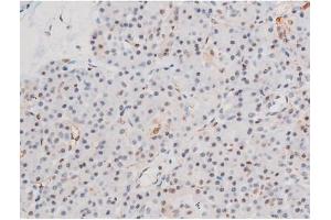 ABIN6267555 at 1/200 staining Human pancreas tissue sections by IHC-P. (LIMK2 Antikörper  (pSer283))