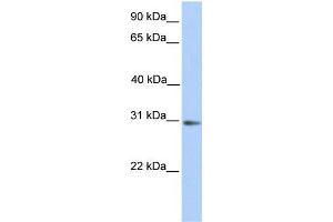Human Placenta; WB Suggested Anti-ABHD13 Antibody Titration: 0. (ABHD13 Antikörper  (N-Term))