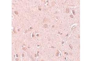 Immunohistochemistry (IHC) image for anti-NSA2 Ribosome Biogenesis Homolog (NSA2) (C-Term) antibody (ABIN1030737) (NSA2 Antikörper  (C-Term))