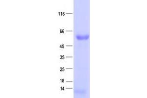 Western Blotting (WB) image for Suppressor of Cytokine Signaling 4 (SOCS4) protein (His tag) (ABIN2732343)